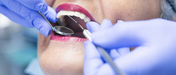 Best Emergency Treatment for Dental Infections or Abscesses in Byron, CA